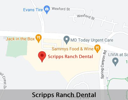 Map image for Options for Replacing Missing Teeth in San Diego, CA