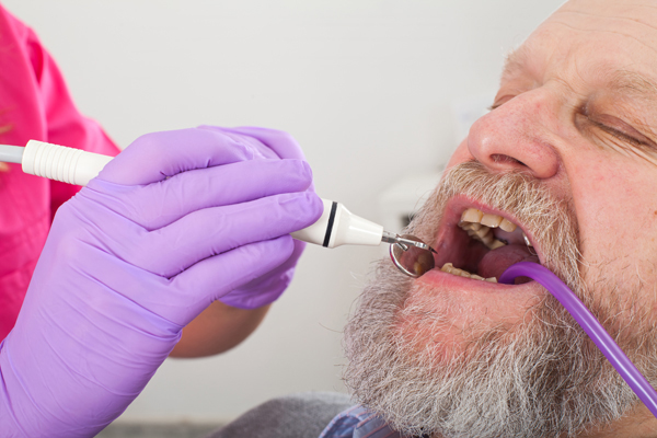 Periodontics: What Is Crown Lengthening?